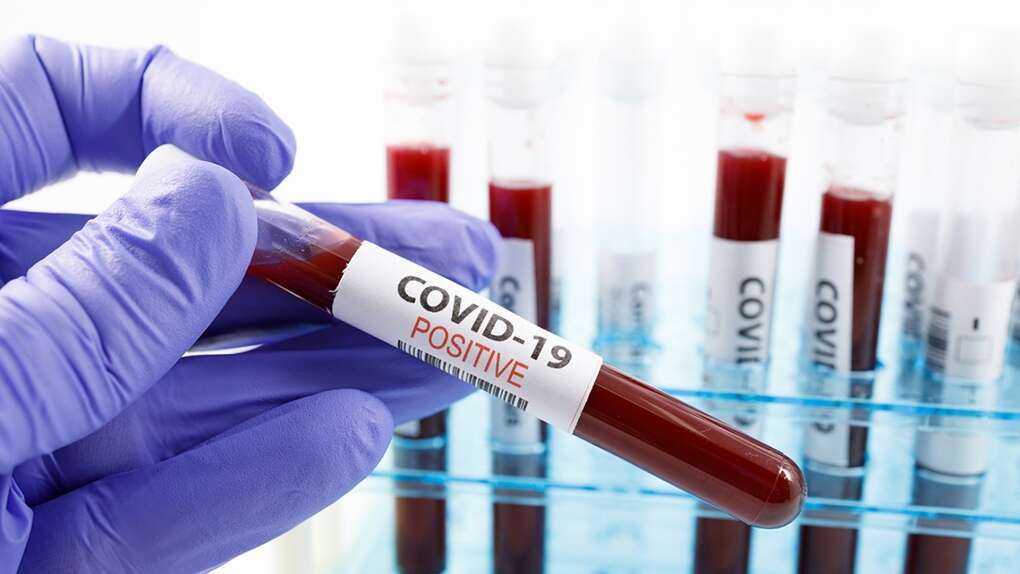 43 health practitioners in Western Region have tested positive for COVID-19 43 health practitioners in Western Region have tested positive for COVID-19