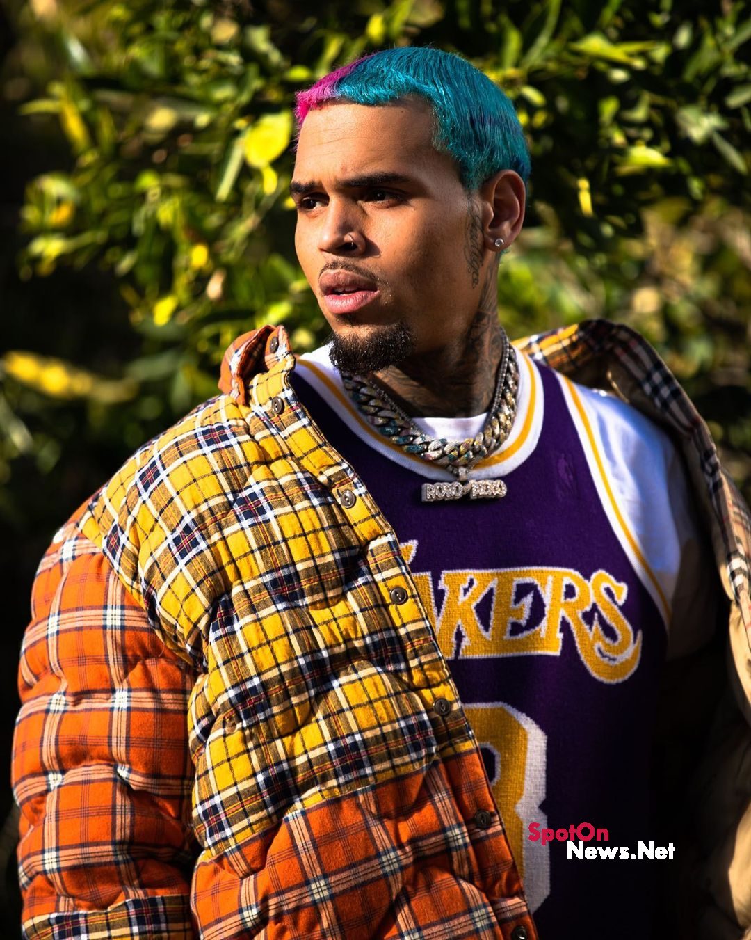 Chris Brown sued by former housekeeper over dog bite