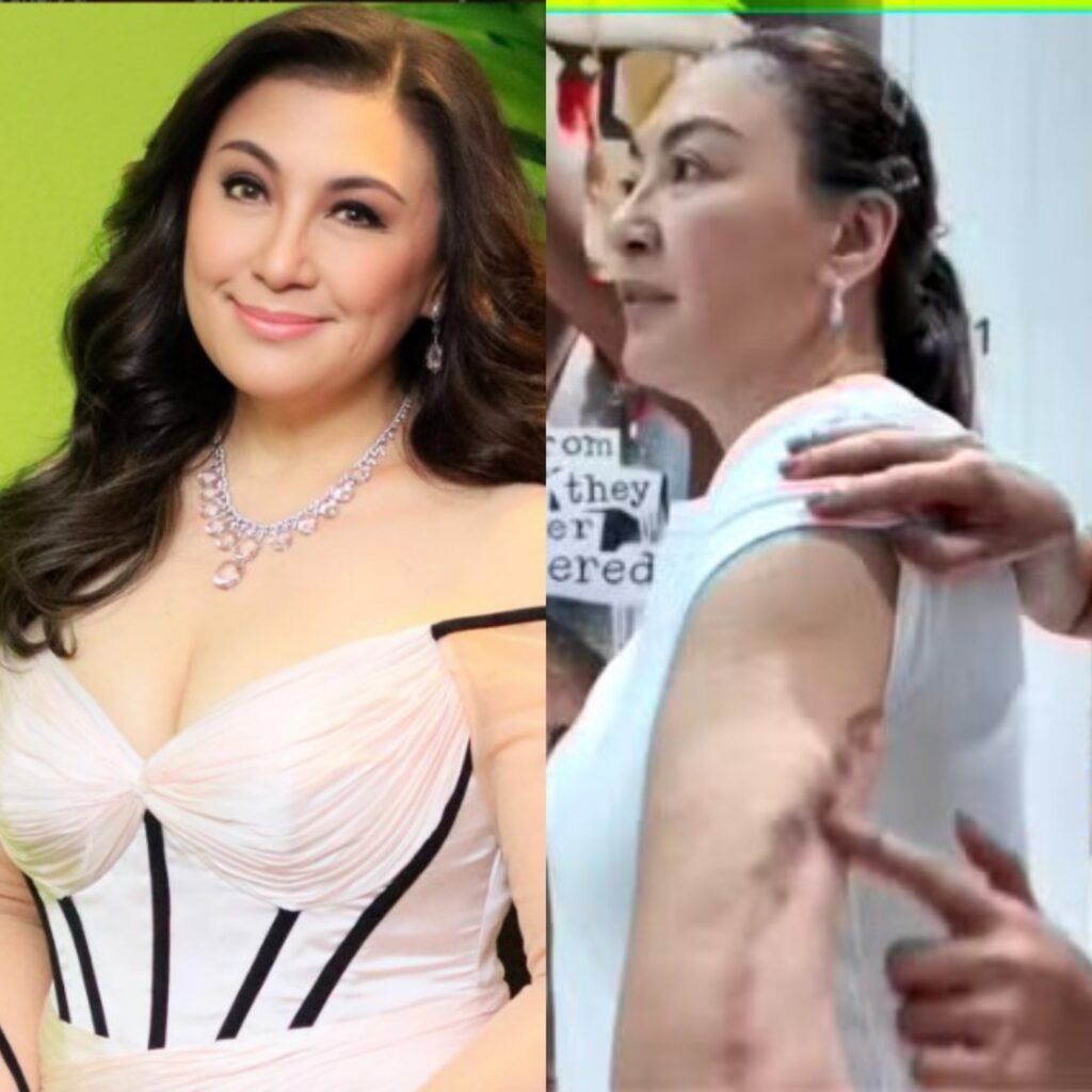 Sharon Cuneta