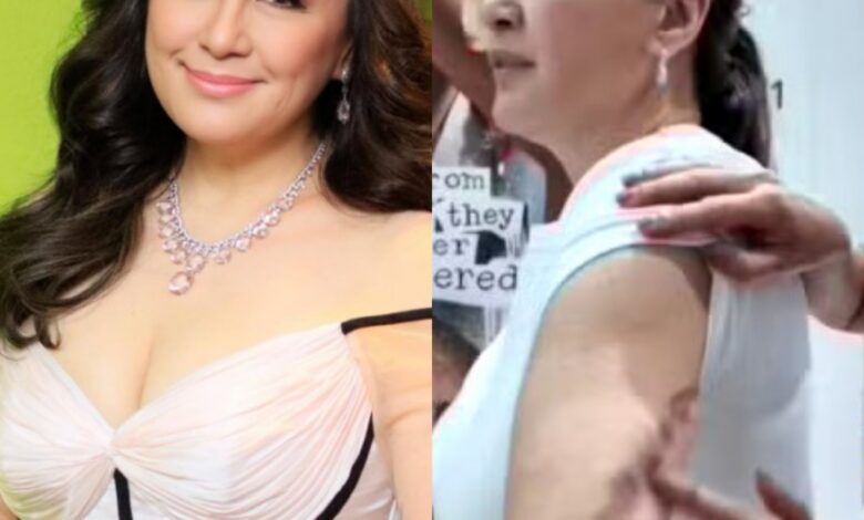 Sharon Cuneta shares scars after breast and skin surgery Sharon Cuneta